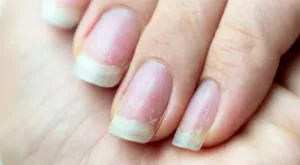 طرق فعالة لتقوية الأظافر ومنع تكسرها - العناية بالأظافر