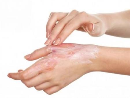 الندبات والجروح